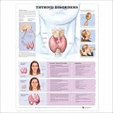 Thyroid Disorders Anatomical Chart