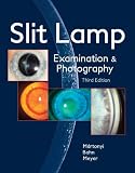 Slit Lamp: Examination and Photography