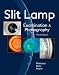 Slit Lamp: Examination and Photography