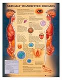 SEXUALLY TRANSMITTED DISEASES laminated 20" x 26"-9765PL1.5