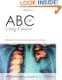 ABC of Lung Cancer (ABC Series)