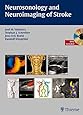 Neurosonology and Neuroimaging of Stroke