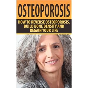 Osteoporosis: How To Reverse Osteoporosis, Build Bone Density And Regain Your Life (Osteoporosis, Bone Density, Strong Bones, Healthy Bones, Osteoporo