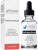 Anti Acne Serum for Men, Women and Teens From Uptown Cosmeceuticals Offers Cutting Edge Skin Care Product that helps to Reduce Acne & Minimize Pores, 30ML