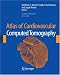 Atlas of Cardiovascular Computed Tomography