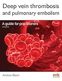Deep vein thrombosis and pulmonary embolism : a guide for practitioners