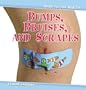 Bumps, Bruises, and Scrapes (Head-To-Toe Health)