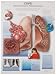 3B Scientific VR1329UU Glossy Paper Copd Chronic Obstructive Pulmonary Disease Anatomical Chart, Poster Size 20" Width x 26" Height