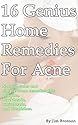 16 Genius Home Remedies for Acne: Natural Cures and Simple Home Remedies for Pimples, Blackheads, Whiteheads, and Blemishes