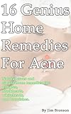 from Jim Bronson 16 Genius Home Remedies for Acne: Natural Cures and Simple Home Remedies for Pimples, Blackheads, Whiteheads, and Blemishes