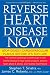 Reverse Heart Disease Now: Stop Deadly Cardiovascular Plaque Before It's Too Late