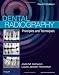 Dental Radiography: Principles and Techniques, 4e
