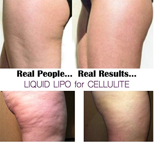 retinol for cellulite