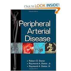 Peripheral Arterial Disease by Robert Dieter, III, Raymond Dieter and Jr., Raymond Dieter
