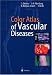 Book Color Atlas of Vascular Diseases