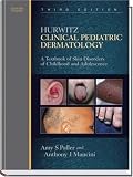 By Amy S. Paller - Hurwitz Clinical Pediatric Dermatology: A Textbook of Skin Disorders of Childhood and Adolescence: 3rd (third) Edition