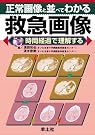 正常画像と並べてわかる救急画像...