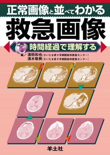 正常画像と並べてわかる救急画像―時間経過で理解する