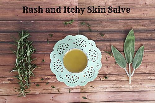 Herbal Mountain Mama Lovely Legs Salve 2 oz / Organic Pain Salve / Sore Muscle Healer / Healing Salve / Salve / Hand Balm / Pain Relief Cream / Essential Oil