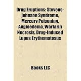 Drug Eruptions: Stevens-Johnson Syndrome, Mercury Poisoning, Angioedema, Warfarin Necrosis, Drug-Induced Lupus Erythematosus