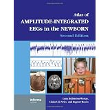 AnAtlasofAmplitude-IntegratedEEGsintheNewborn,SecondEdition,withDVD(EncyclopediaofVisualMedicineSeries)