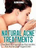 Natural Acne Treatments: Home Remedies For The Best Acne Treatment Skin Care Including Teenage Acne, Adult Acne, Acne Scars and Back Acne