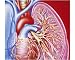 Photographic Print of Bronchitis from Science Photo Library