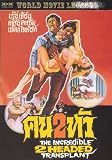 THE INCREDIBLE 2 HEADED TRANSPLANT - Rare DVD - NEW