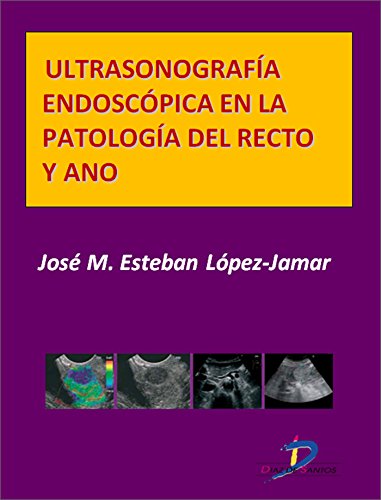 Ultrasonografía endoscópica en la patología del recto y ano  (Este capítulo pertenece al libro Tratado de ultrasonografía abdominal) (Spanish Edition)