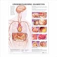 Understanding Diabetes Anatomical Chart by  Anatomical Chart Company