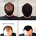 Samson Hair Building Fibers Hair Loss Concealer DARK BROWN XL REFILL 100gr Made in USA Available Worldwide