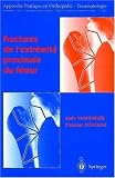 Fractures de l'extr�mit� proximale du f�mur