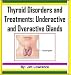 Thyroid Disorders and Treatments: Underactive and Overactive Glands