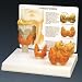 Thyroid Disease Model G315
