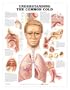 Understanding the Common Cold Chart