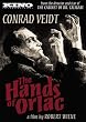 Hands of Orlac [DVD] [1924] [Region 1] [US Import] [NTSC]