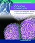 Colon Cancer: Current and Emerging Trends in Detection and Treatment (Cancer and Modern Science)