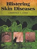 Blistering Skin Diseases