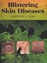 Blistering Skin Diseases
