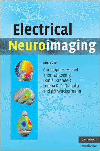 Electrical Neuroimaging