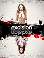 Excision