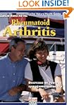 Rheumatoid Arthritis: Decrease or rev...