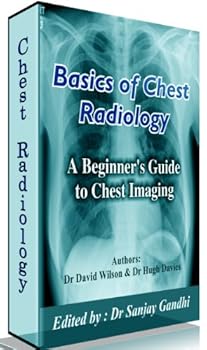 basics of chest radiology - dr david wilson. dr hugh davies and dr sanjay gandhi basics of chest radiology - dr david wilson. dr hugh davies and dr sanjay gandhi