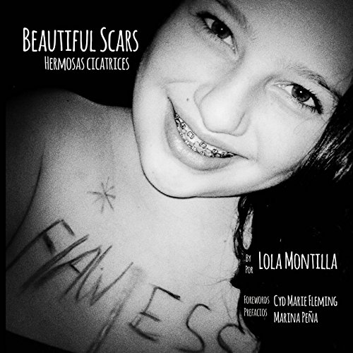 beautiful scars  hermosas cicatrices english and spanish edition