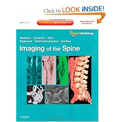 Imaging of the Spine: Expert Radiology Series, Expert Consult-Online and Print by Thomas P. Naidich MD, Mauricio Castillo MD, Soonmee Cha MD and Charles Raybaud MD
