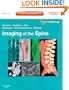 Imaging of the Spine: Expert Radiology Series, Expert Consult-Online and Print, 1e