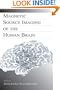 Magnetic Source Imaging of the Human Brain