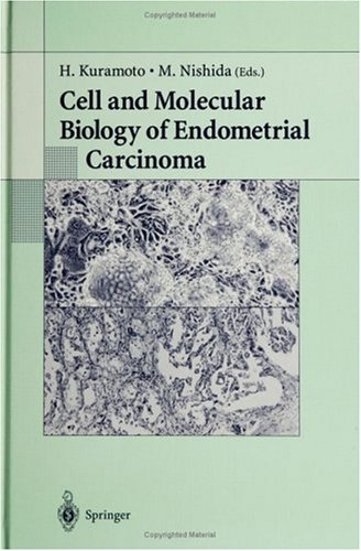Endometrial-Cancer