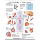 Understanding Hypertension Anatomical Chart in Spanish (Entendiendo Que Es la Hypertension)