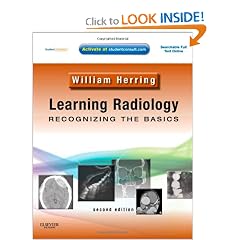 Learning Radiology: Recognizing the Basics (With STUDENT CONSULT Online Access) by William Herring